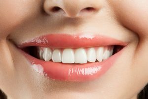Woman showing her gums
