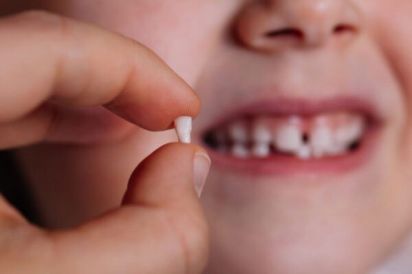 What to do when your child has loose teeth